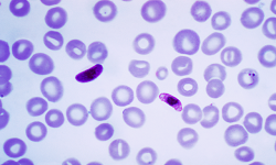 Plasmodium falciparum